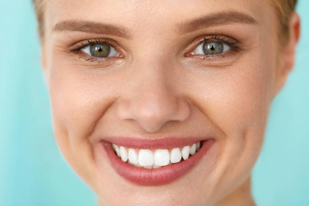 Beauty Woman Face. Closeup Portrait Of Beautiful Happy Girl With Perfect Smile And White Teeth. Cheerful Healthy Female With Fresh Soft Skin Smiling. Health, Skin Care Concept. High Resolution Image