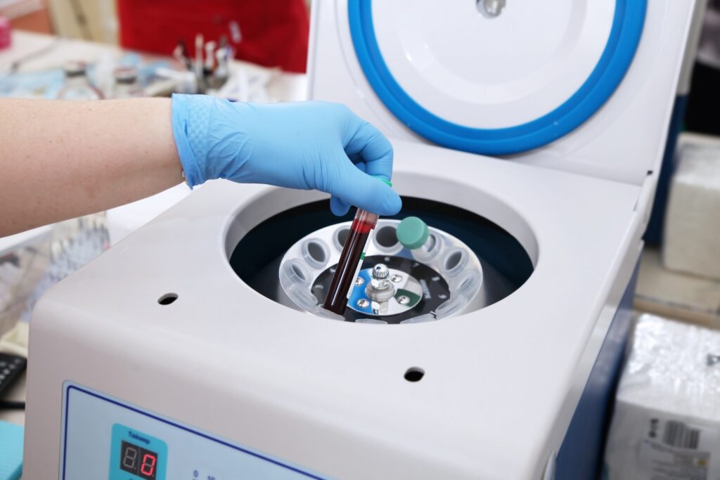 Tube of blood is placed in a medical centrifuge for plasma lifting Tube of blood is placed in a medical centrifuge for plasma lifting